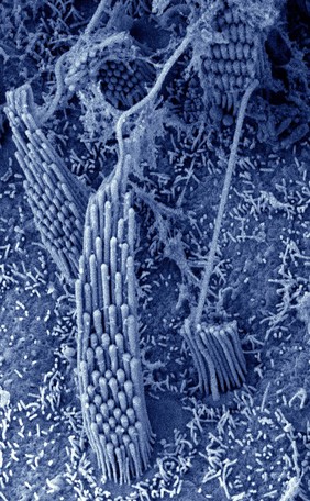 Stereocilia in the vestibular organ