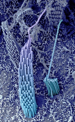 view Stereocilia in the vestibular organ