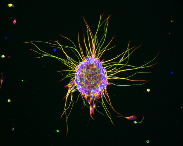 Neurons in culture