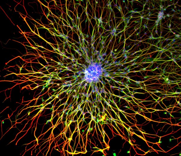 Neurons in culture