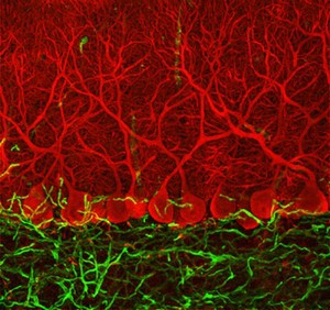 view Purkinje cells in the cerebellum