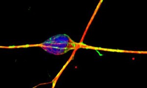 view Cerebellar granule neuron in culture