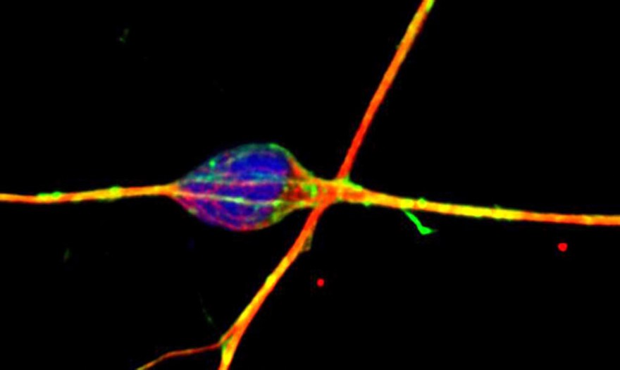 Cerebellar granule neuron in culture