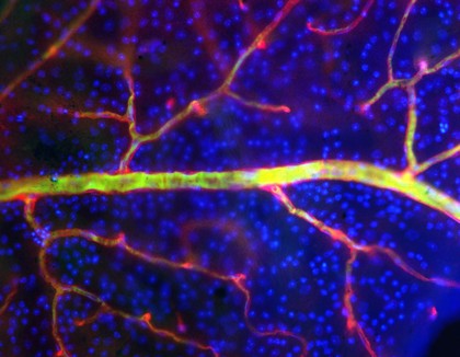 Blood vessels in the retina showing the endothelial cells in red and the vascular contents in green. Surrounding cell nuclei are stained blue.
