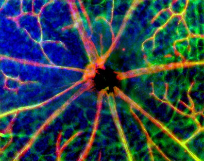 Blood vessels emerging from the optic disc