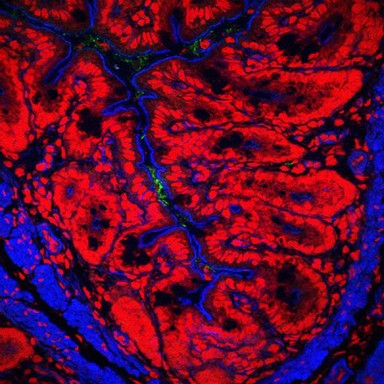 Mouse colon infected with Citrobacter rodentium