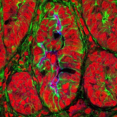 Mouse colon infected with Citrobacter rodentium