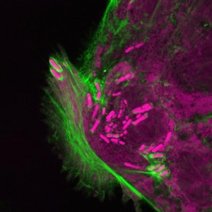 view Shigella infection