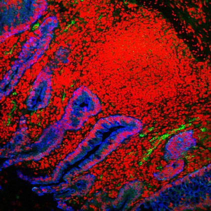 Human small intestine showing villi and glands. The cytokeratinin the cells is stained blue, the cell nuclei are stained red and the endothelial cells lining the blood vessels are stained green.