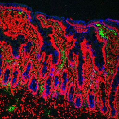 Human small intestine showing villi and glands. The cytokeratinin the cells is stained blue, the cell nuclei are stained red and the endothelial cells lining the blood vessels are stained green.