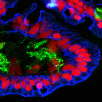 Human small intestine showing villi. The cytokeratinin the cells is stained blue, the cell nuclei are stained red and the endothelial cells lining the blood vessels are stained green.