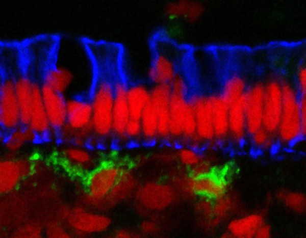 Human small intestine showing the columnar epithelium. The cytokeratinin the cells is stained blue, the cell nuclei are stained red and the endothelial cells lining the blood vessels are stained green.