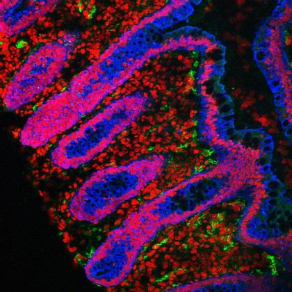 Human small intestine showing villi and glands. The cytokeratin in the cells is stained blue, the cell nuclei are stained red and the endothelial cells lining the blood vessels are stained green.