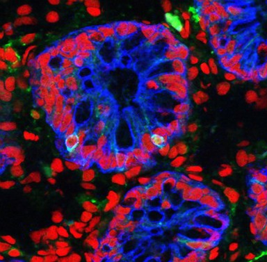 Neuroendocrine cells in the small intestine