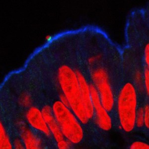 view A single enteropathogenic E. coli in the intestine