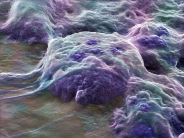 Human embryonic stem cells