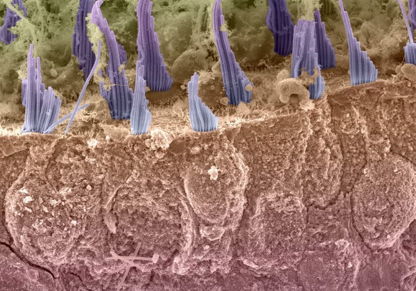 Hair cells in the utricle