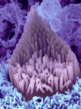 Developing inner hair cell