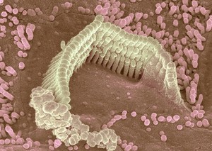 view Outer hair cells damaged by kanamycin