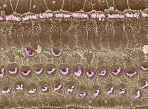 view Outer hair cells damaged by kanamycin