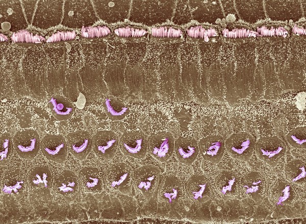 Outer hair cells damaged by kanamycin