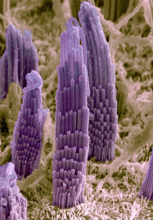 view Vestibular hair cells