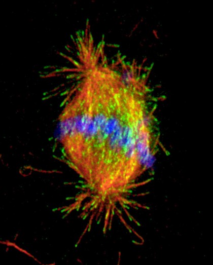 Chromosomes at metaphase