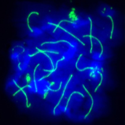 Meiosis