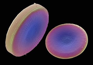 view Diatom frustules