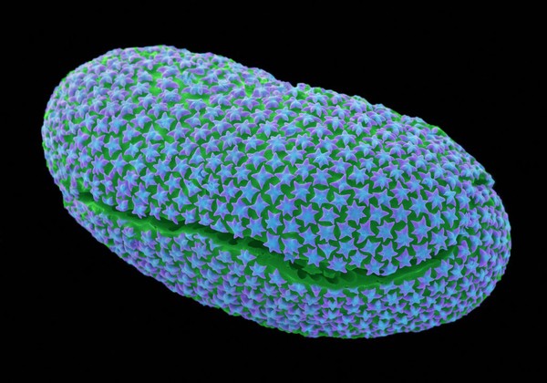 A diatom frustule