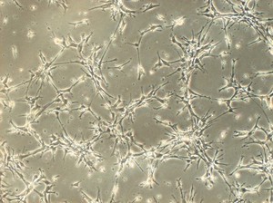 view Human neural stem cells growing in culture. Neural stem cells can be made to develop into cells found in the central nervous system; neurons, astrocytes and oligodendrocytes.