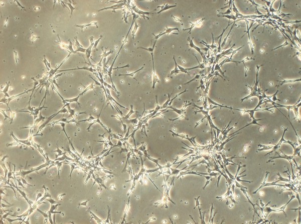 Human neural stem cells growing in culture. Neural stem cells can be made to develop into cells found in the central nervous system; neurons, astrocytes and oligodendrocytes.