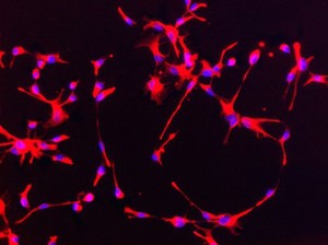 view Human neural stem cells stained for nestin (red). Nestin is a type of intermediate filamant protein that is used as a marker of neural stem cells. The blue dots are the cell nuclei stained with DAPI. Neural stem cells can be made to develop into cells found in the central nervous system; neurons, astrocytes and oligodendrocytes.