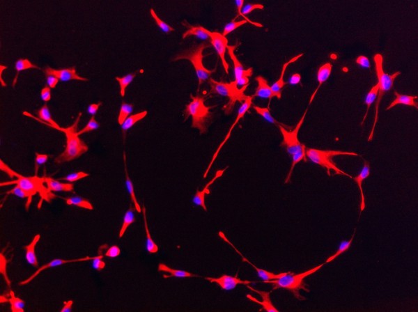 Human neural stem cells stained for nestin (red). Nestin is a type of intermediate filamant protein that is used as a marker of neural stem cells. The blue dots are the cell nuclei stained with DAPI. Neural stem cells can be made to develop into cells found in the central nervous system; neurons, astrocytes and oligodendrocytes.