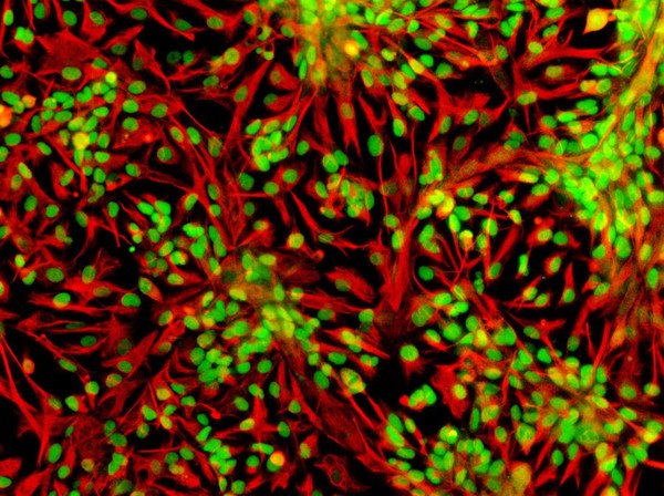 Human neural stem cells stained for Sox2 (green) and vimentin (red). Both are markers of neural stem cells.