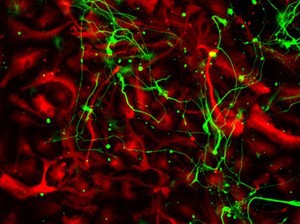 view Differentiated neural stem cells