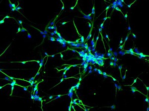 view Neurons derived from human neural stem cells.