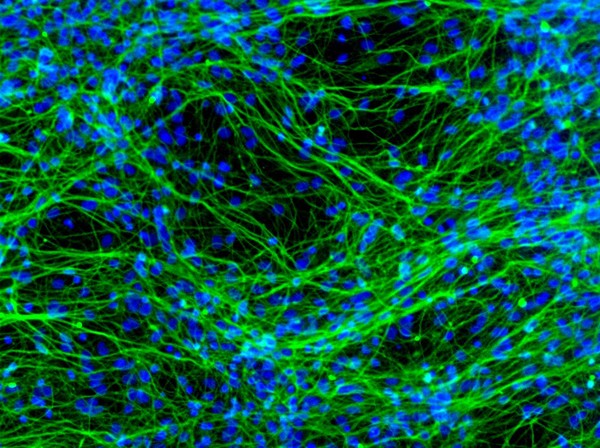 Neurons derived from human neural stem cells. The green staining highlights the typical appearance of differentiated nerve cells. Cells such as these could form the basis of future treatments for degenerative brain diseases such as Parkinson's and Alzheimer's.