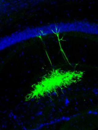 Neural stem cells transplanted into a mouse brain