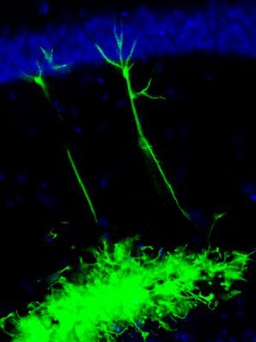 Neural stem cells transplanted into a mouse brain