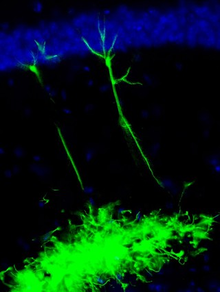 Neural stem cells transplanted into a mouse brain