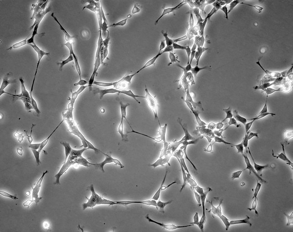 Mouse neural stem cells growing in culture. Neural stem cells can be made to develop into cells found in the central nervous system; neurons, astrocytes and oligodendrocytes.