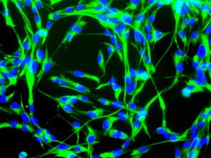 view Mouse neural stem cells growing in culture. Neural stem cells can be made to develop into cells found in the central nervous system; neurons, astrocytes and oligodendrocytes.