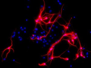 view Neurons derived from neural stem cells