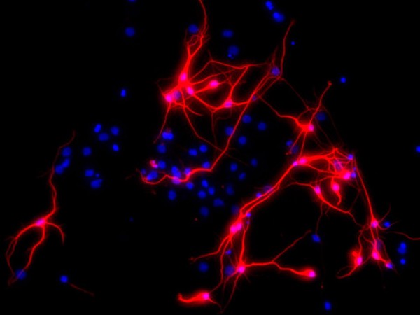 Neurons derived from neural stem cells