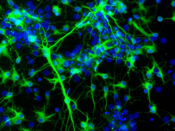 Neurons derived from neural stem cells