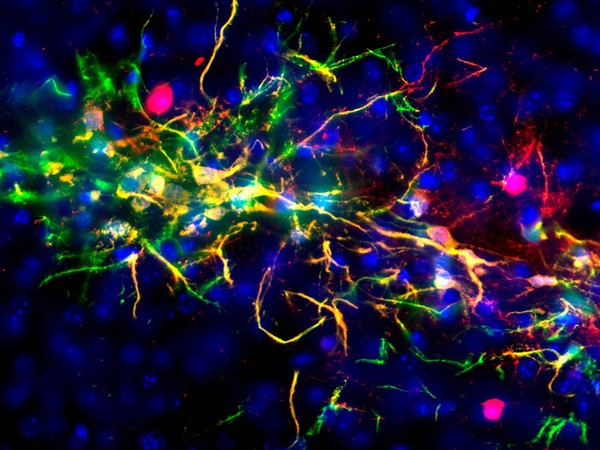 Transplanted neural stem cells giving rise to neurons