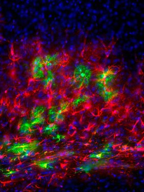 Neural stem cells transplanted into mouse brain