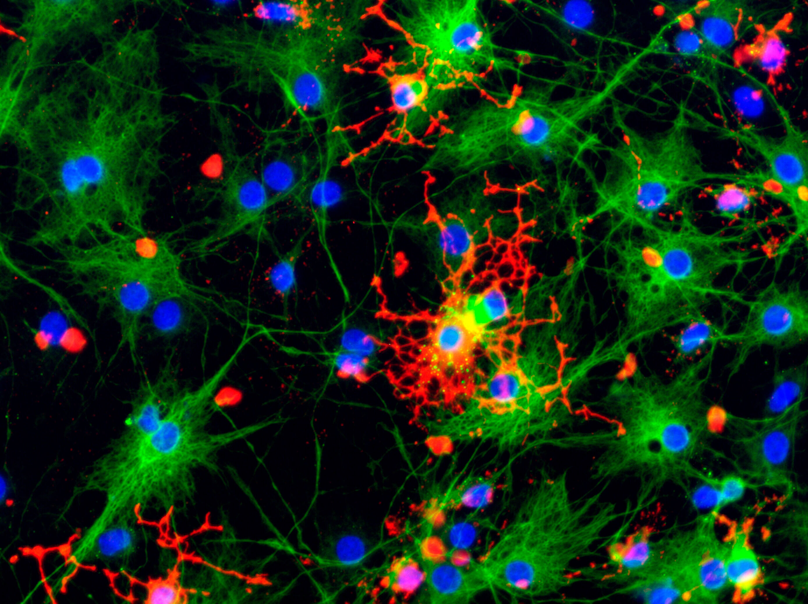Neural f. Конфокальная микроскопия клетки. Конфокальная микроскопия нейронов. Конфокальная микроскопия крови. Олигодендроциты микрофотографии.