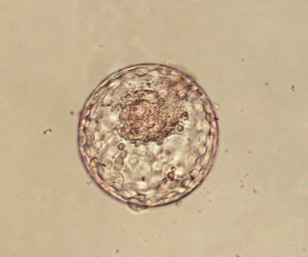 Human blastocyst within the zona pellucida